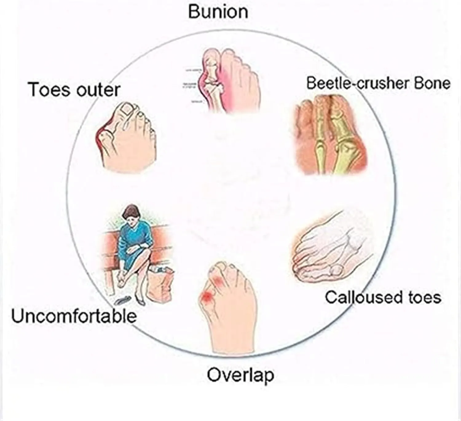 BBPM Sandals for Women Casual Summer Wedge Leather Sandals with Arch Support Summer Breathable Adjustable Orthopedic Wedge Slip On Sandals